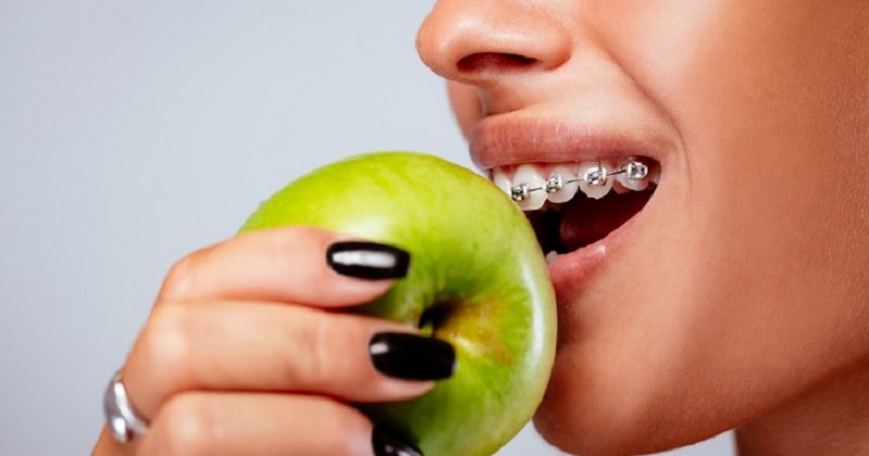 Hạn chế ăn đồ ăn dai, cứng làm ảnh hưởng đến răng và mắc cài