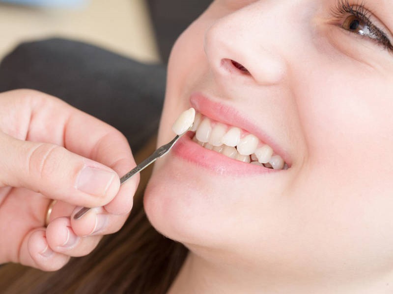 Tuổi thọ sử dụng lâu, nếu như được chăm sóc răng đúng cách, kỹ lưỡng