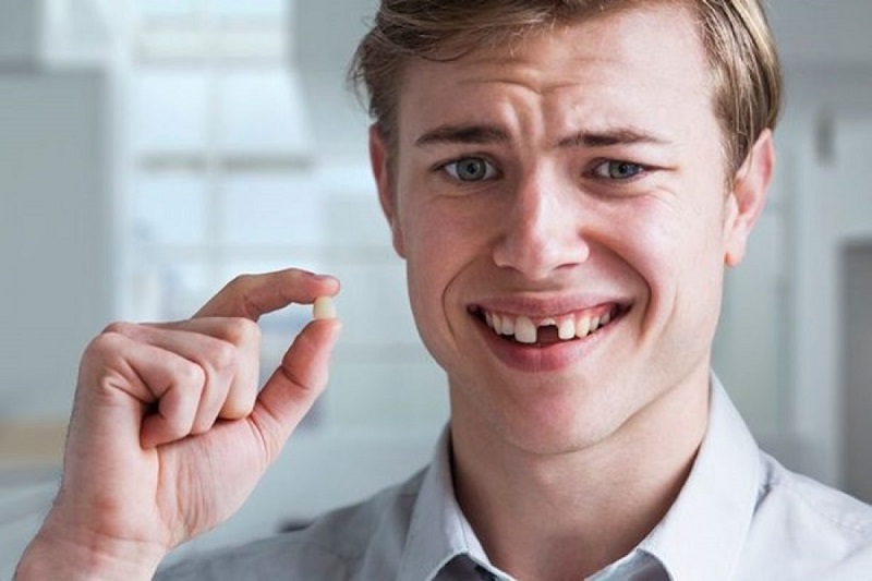Nhổ răng không trồng lại có sao không - làm ảnh hưởng tới cung hàm