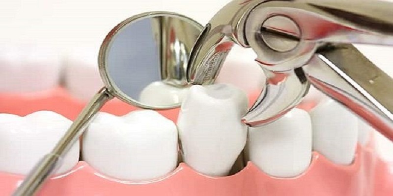 Thời gian trồng lại răng sau bao lâu nó sẽ phụ thuộc vào một số yếu tố