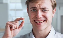 Nhổ răng không trồng lại có thể khiến hàm răng bị xô lệch