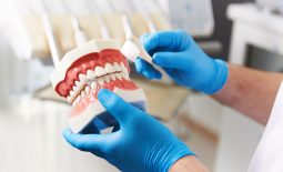 Người bị mất một, nhiều răng liền kề hoặc nguyên hàm thì nên trồng răng giả tháo lắp