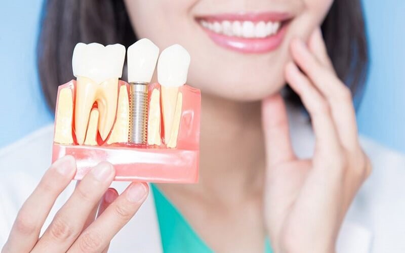 Người bệnh cần thận trọng với các quảng cáo trồng răng Implant giá rẻ