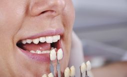 Giải đáp nhanh trồng răng sứ vĩnh viễn có đau không?