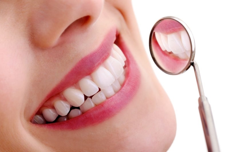 Trồng răng sứ cố định mang lại nhiều lợi ích tuyệt vời